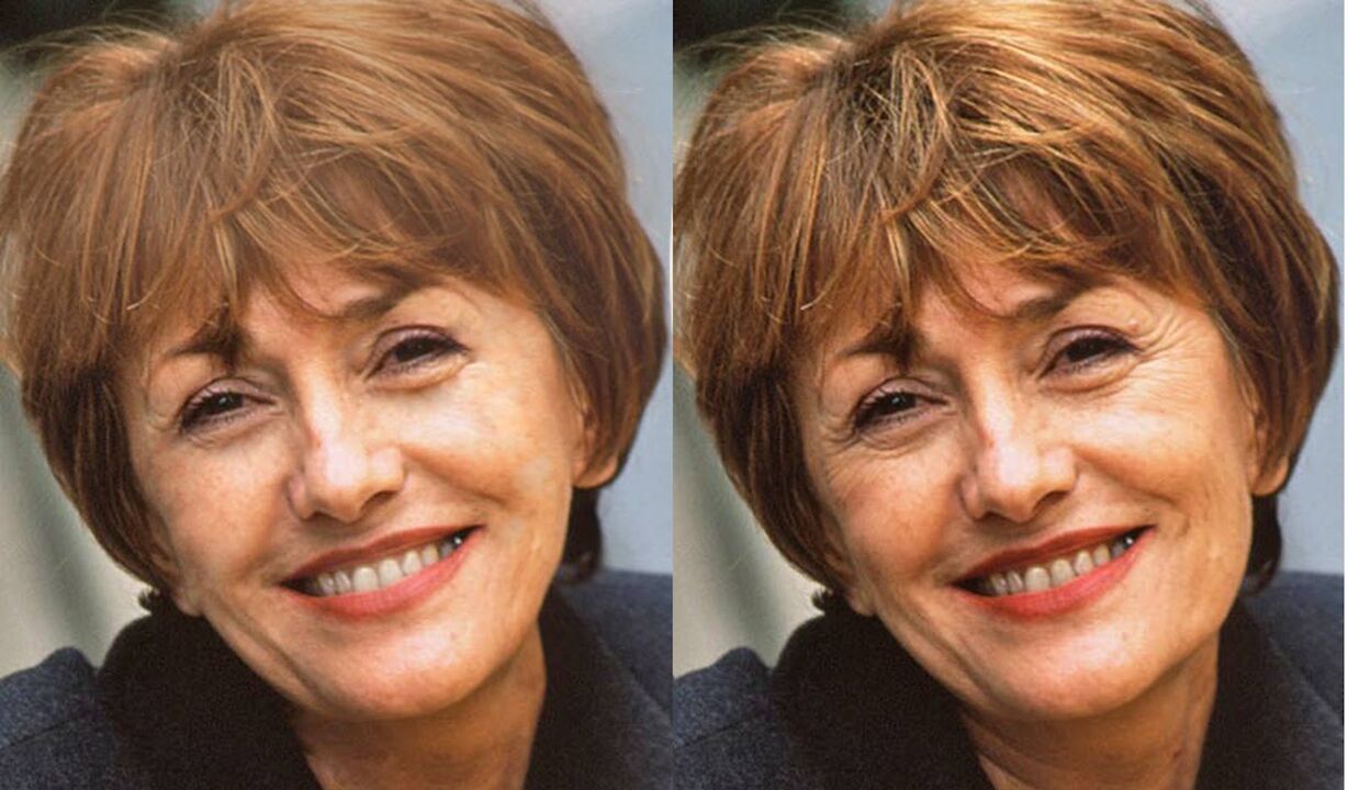 Foto wajah sebelum dan selepas kontur